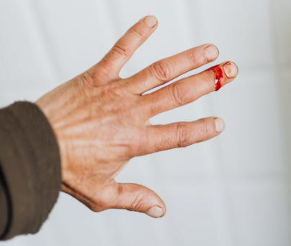 donor darah mempercepat proses penyembuhan luka