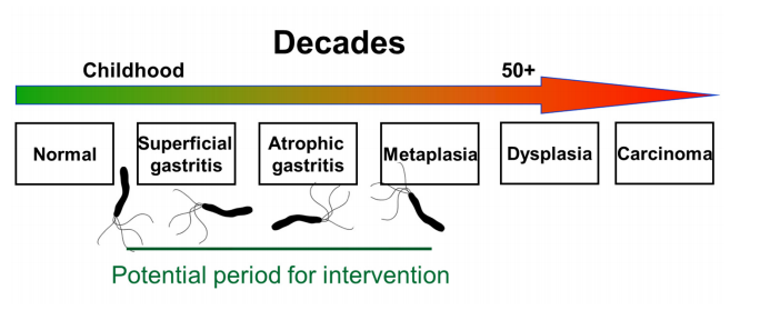 diagram WHO perkembangan infeksi bakter h pylori menjadi kanker - asuransinow.com