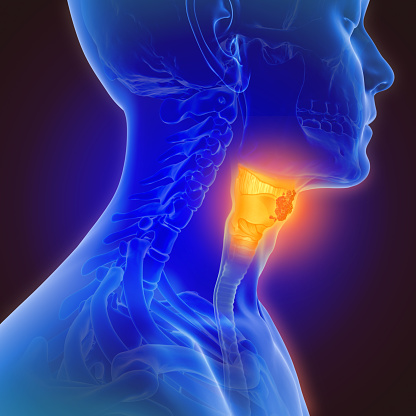 https://media.istockphoto.com/photos/3d-illustration-of-throat-cancer-picture-id1130880428?b=1&k=6&m=1130880428&s=170667a&w=0&h=thEuq-DZmcFPyUXBBHggDa9FHM3QXyAAezxNPPAN6XE=