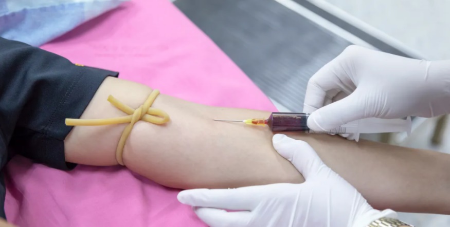 pemeriksaan psa adalah pemeriksaan prostat paling awal (asuransinow.com)