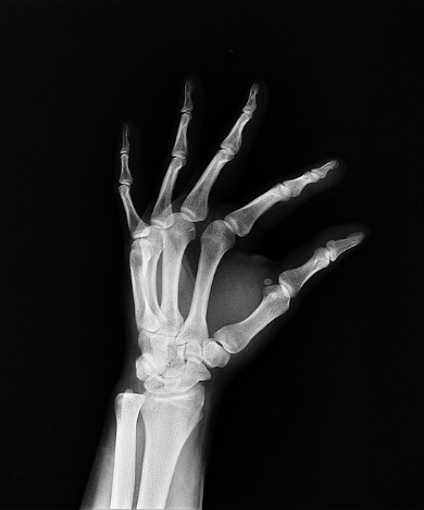 A close-up of a boneDescription automatically generated with low confidence